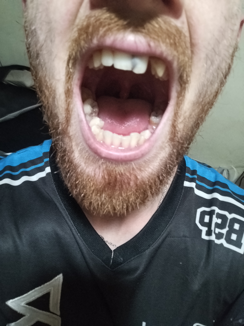 Ayúdame a recuperar mi sonrisa 