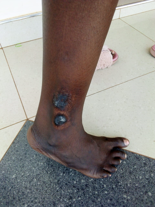Skin disease is taking over my life--Urgent help needed